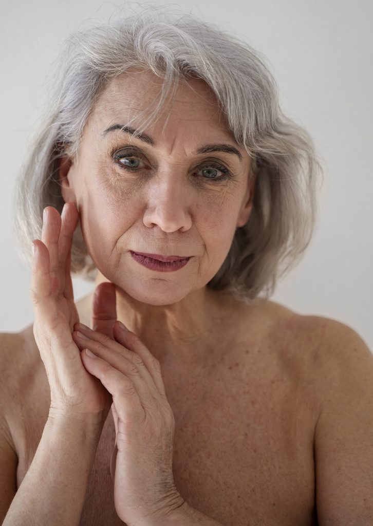 Prevenir acné en mujeres mayores